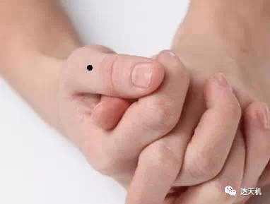 左手大拇指痣左手大拇指的痣代表工作努力、有责任感、得长辈疼爱。无名