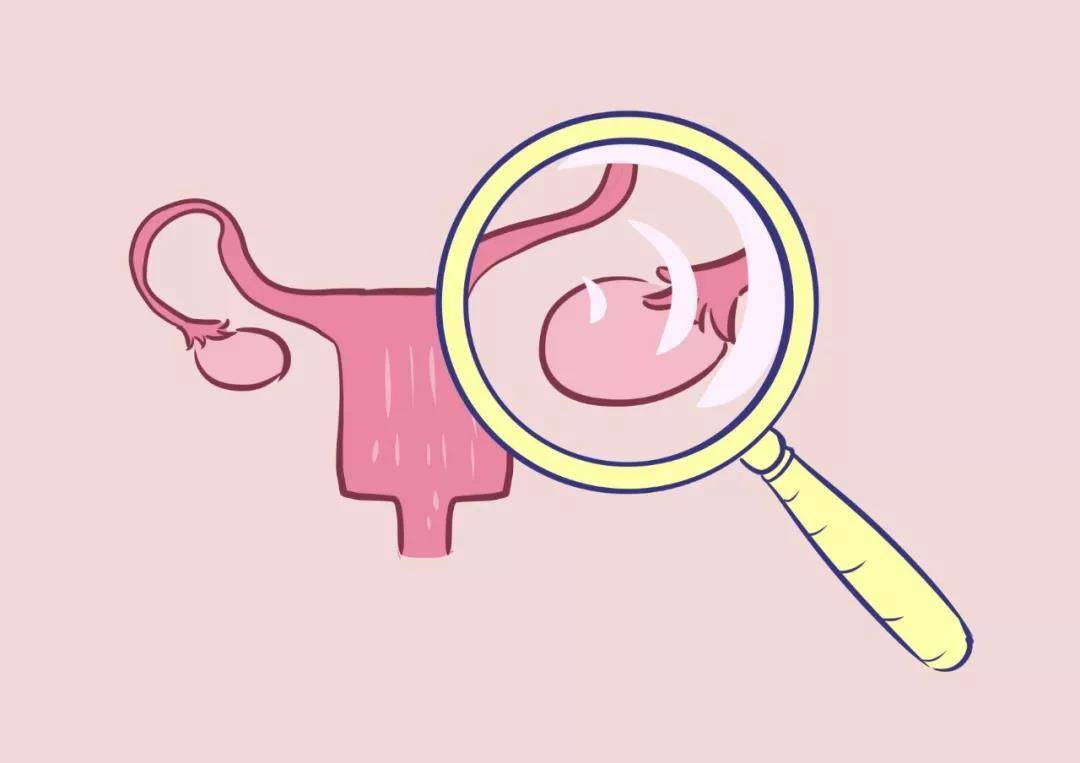 哪些卵巢疾病会影响怀孕？(图1)