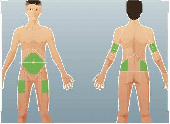 图解胰岛素正确注射方式,快收藏!_部位_患者_针头