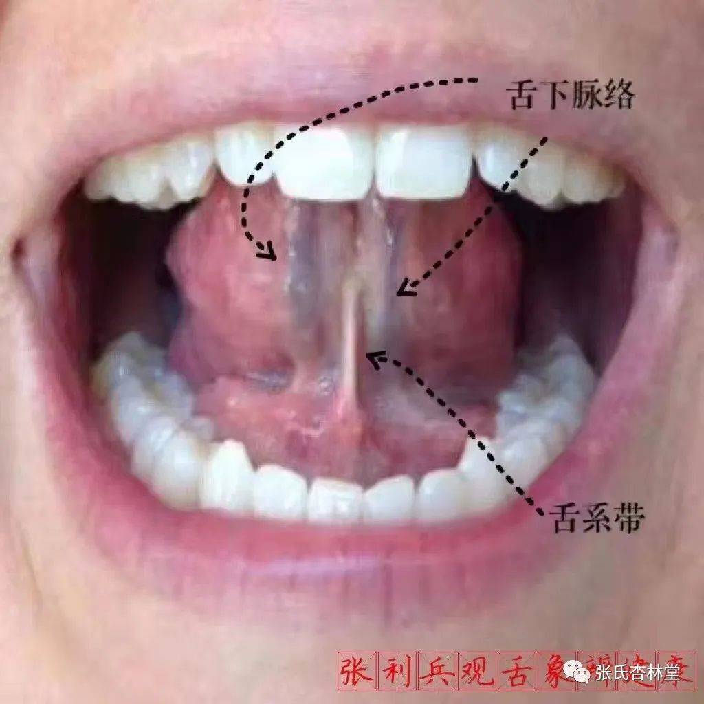 在这个在解剖学来说的话称之为舌下二府,我们中医有两个穴位,也就是