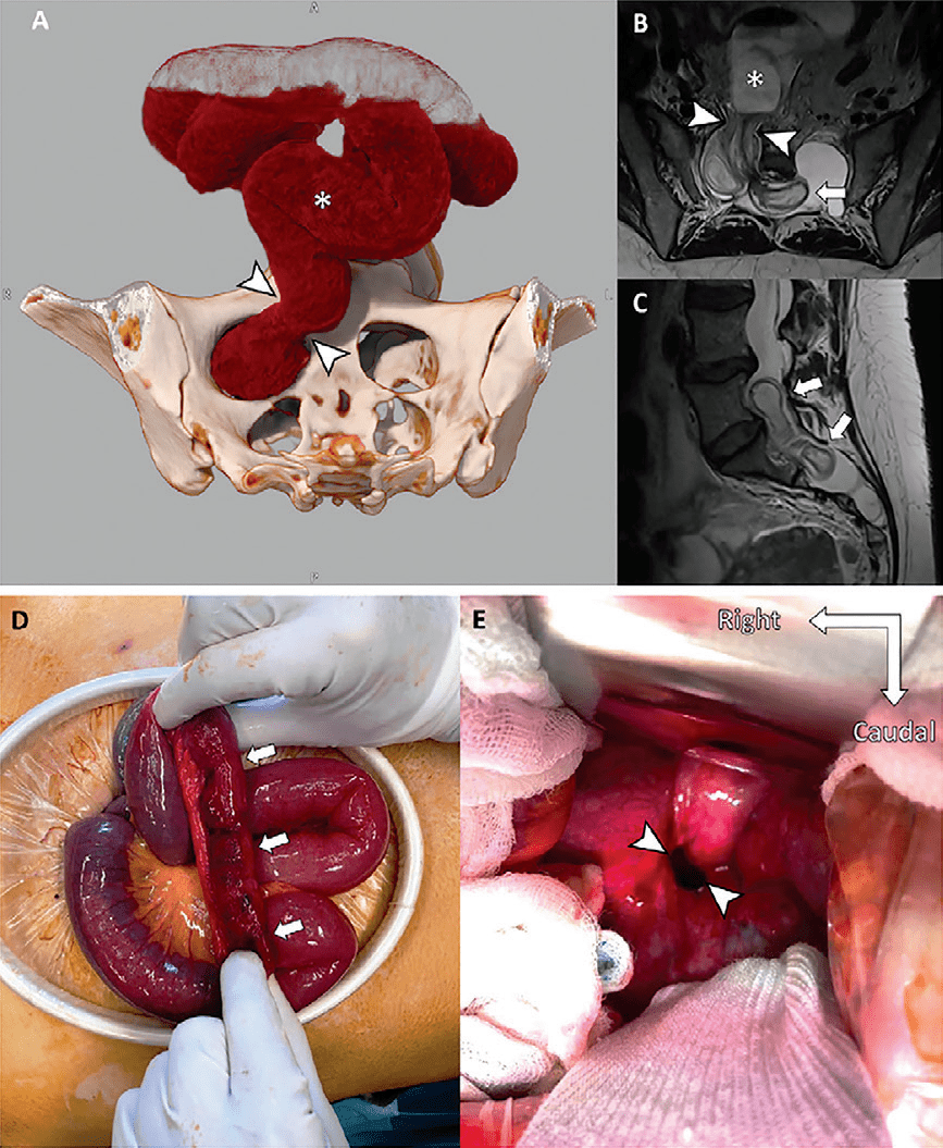 Χۣ2022ȶRadiologyѡ𺳵 ...