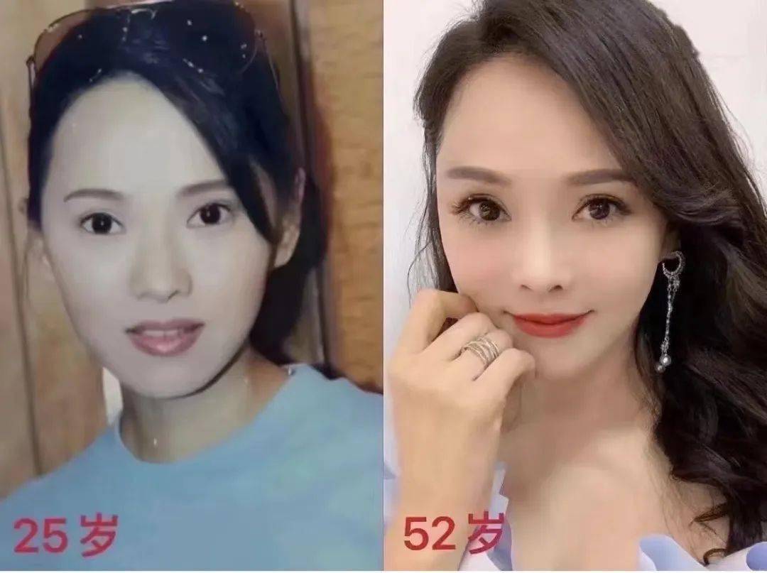 口碑炸裂！女明星同款ReFa美容仪2折捡漏，28天淡纹紧致更年轻