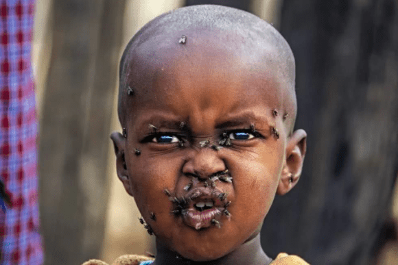 照片里有一个来自非洲的一个小男孩不仅骨瘦如柴还浑身爬满苍蝇,这个