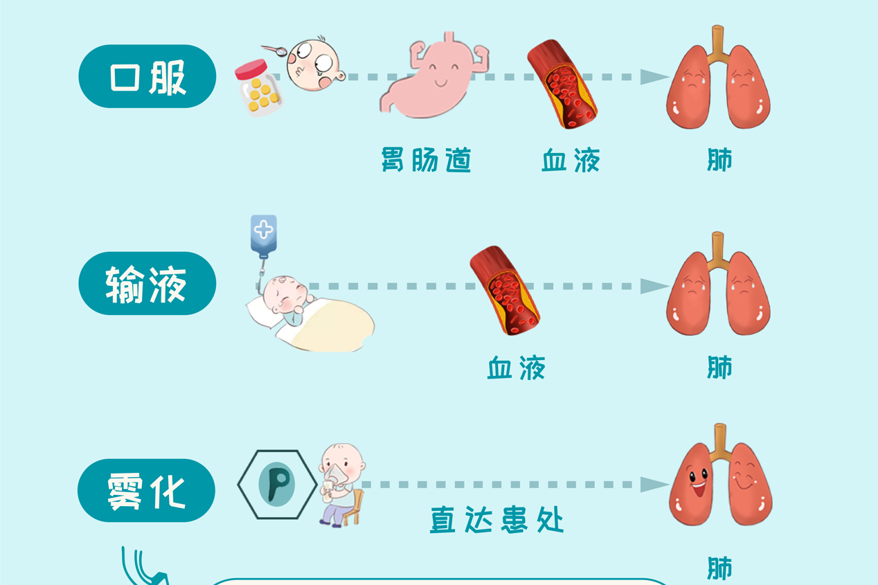 孩子咳嗽,在家雾化吸入能帮助及时缓解症状——普米克