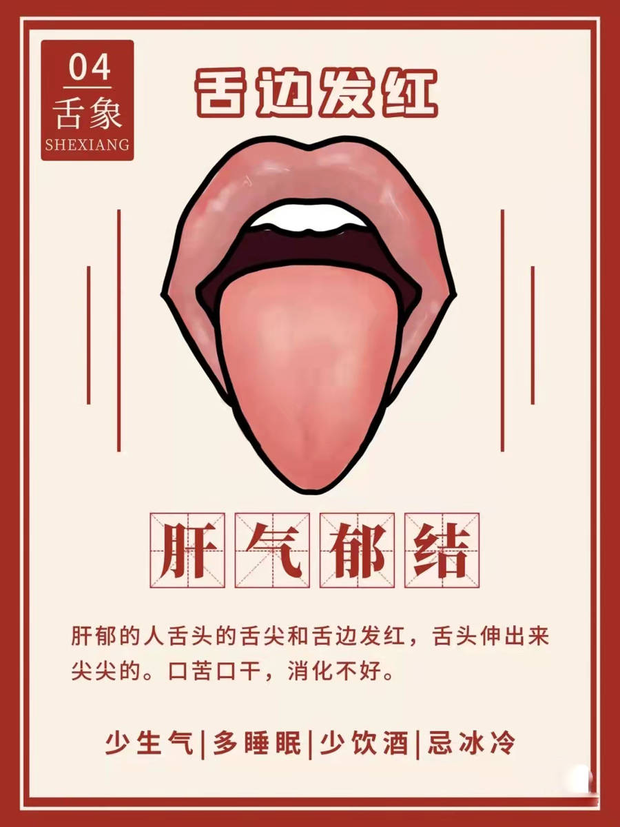 从舌苔看健康,跟中医学舌诊,这7种要注意-搜狐大视野-搜狐新闻