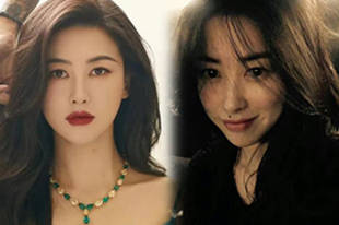 朱珠点痣前后对比 实打实美女辨识度超高