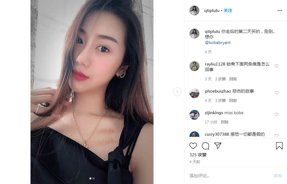 孙悦妻子缅怀科比,她晒出个人美照,黑曼巴曾录视频送祝福_陈露