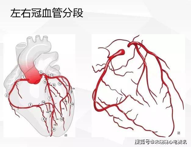 房室結動脈80%來於右冠狀動脈,20%來源於左冠狀動脈竇房結由竇房結