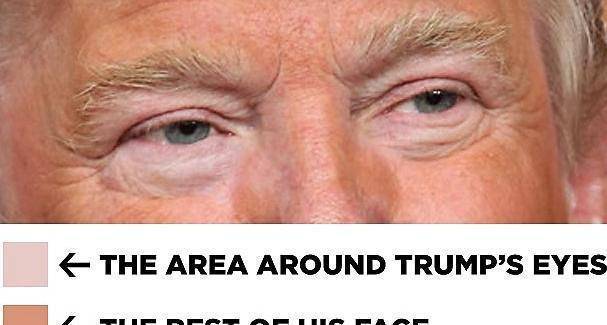 为什么特朗普脸是黄色的眼睛周围却是白色的原来是种病