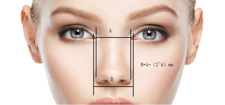 (2)鼻宽度鼻根点到鼻翼基底的长度也会影响正面鼻长度.