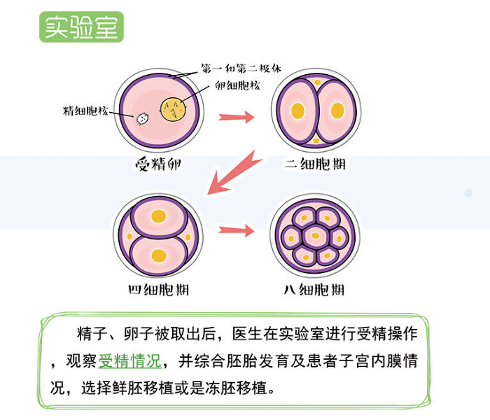 试管婴儿怎么做的全过程案例(原来做试管婴儿的过程是这样的,看完有点心疼妈妈)-第1张图片-鲸幼网