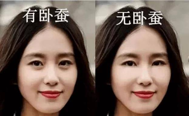 赵丽颖去掉卧蚕像网红脸,她没了卧蚕像整容失败