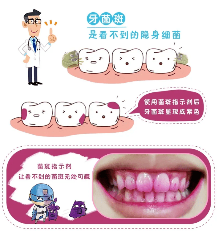 牙菌斑快把我的牙齿挖空了怎么办在线等挺急的