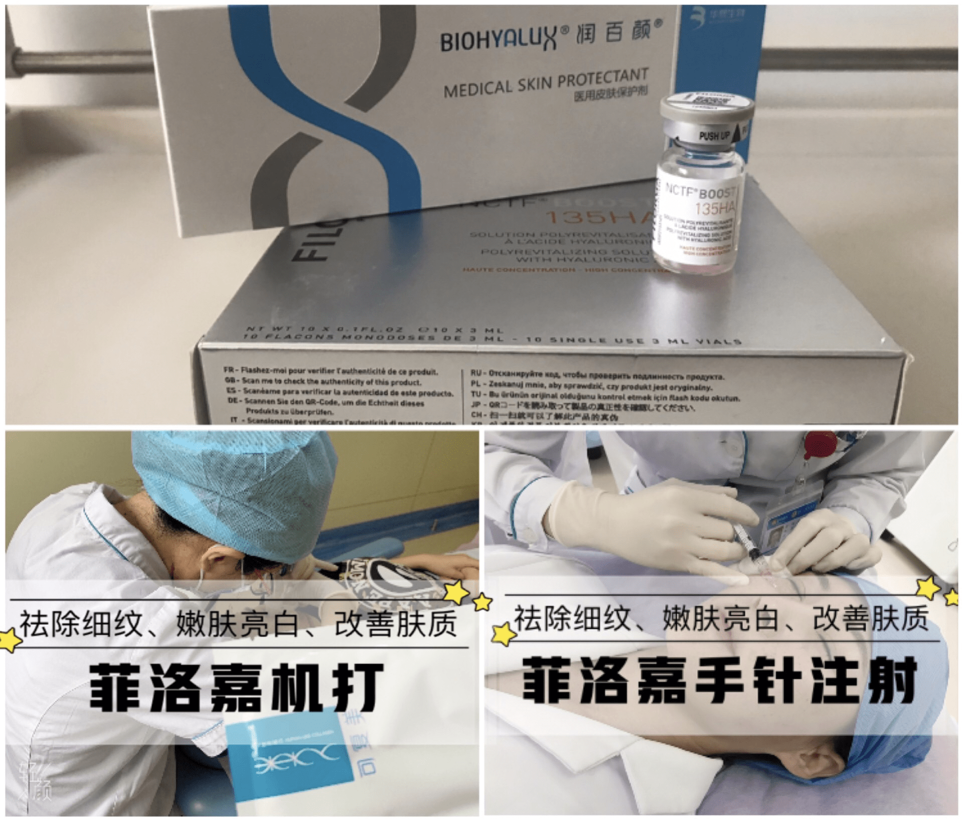 北京健宫医院菲洛嘉复合水光疗法,采用手针结合德玛莎机器注射方式