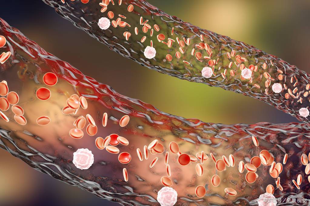 若不想血液"粘稠如粥",这5类食物趁早忌口,血管可能会感谢你