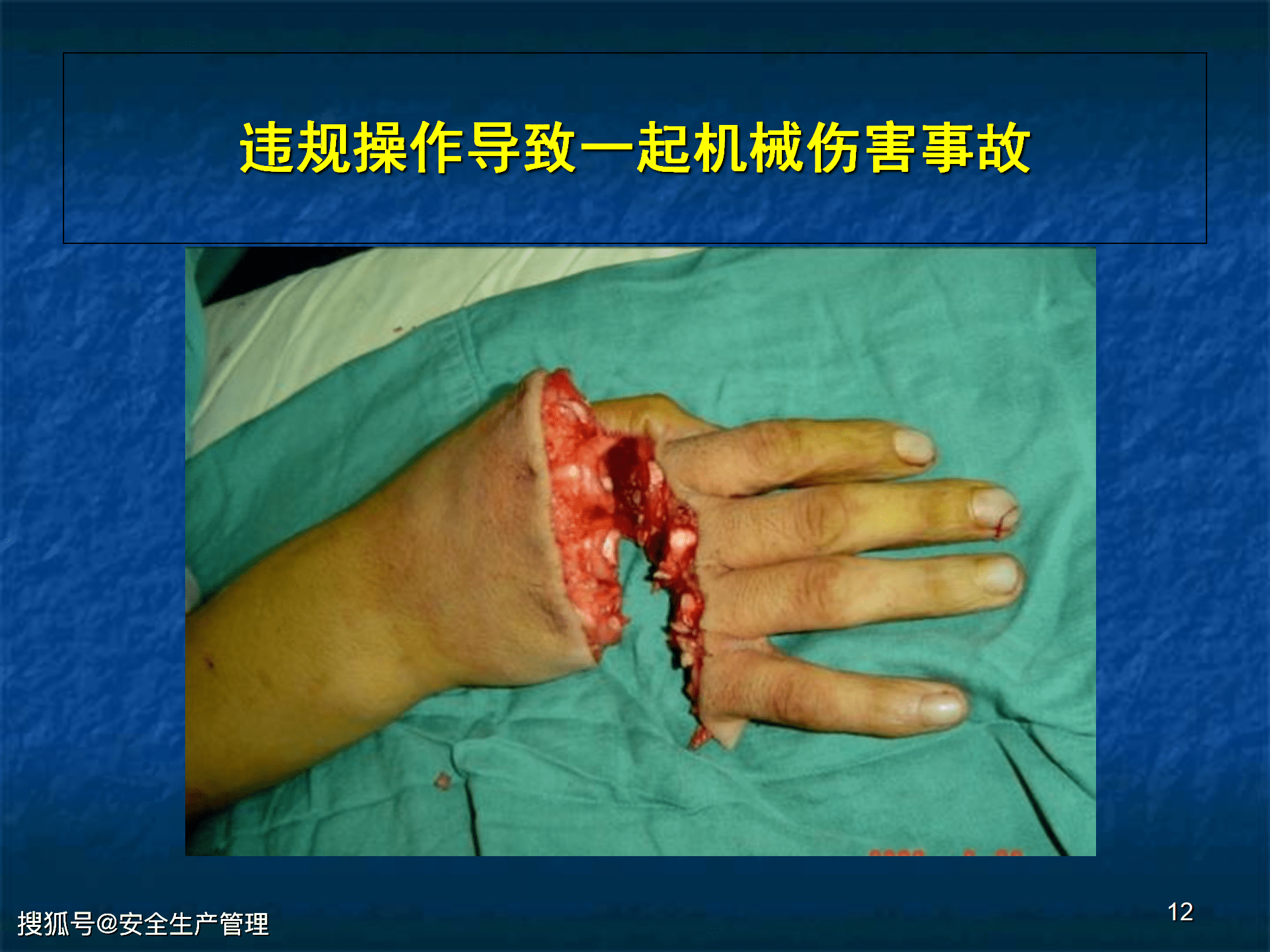 机械安全生产基本知识及事故防范