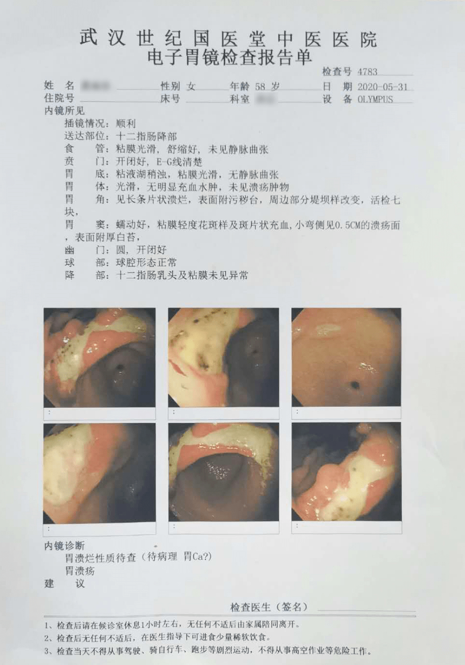 胃癌图片和胃糜烂图片图片