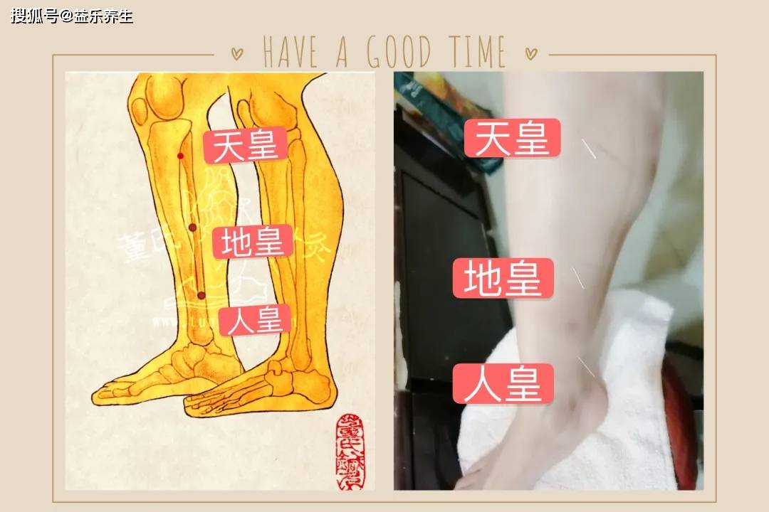 史继霞董氏奇穴特效针灸—打鼾处方_阻塞