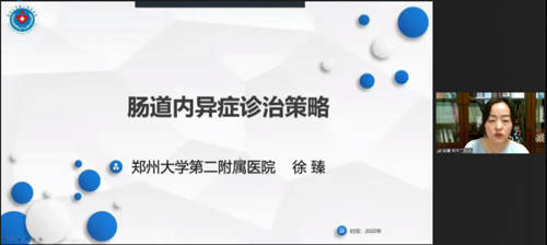 《卵巢子宫内膜异位囊肿病例》分享许昌市中心医院赵维楠教授进行