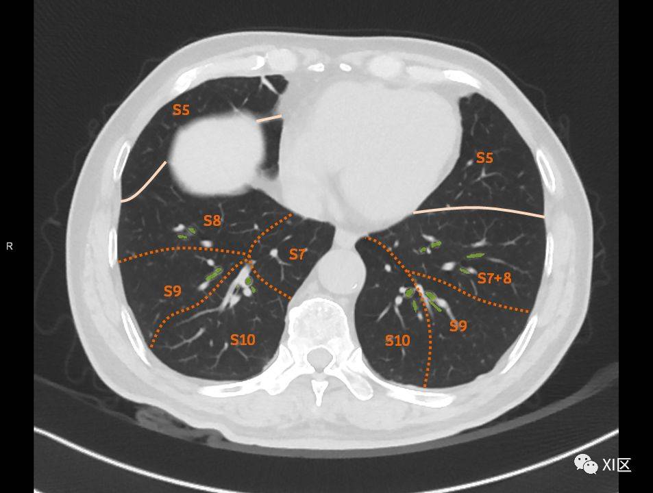 如此詳細的肺部影像解剖有點兒酷