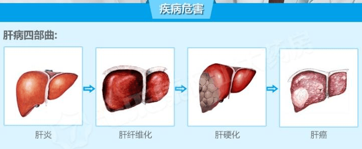 干细胞疗法对肝纤维化的临床研究进展!_肝脏