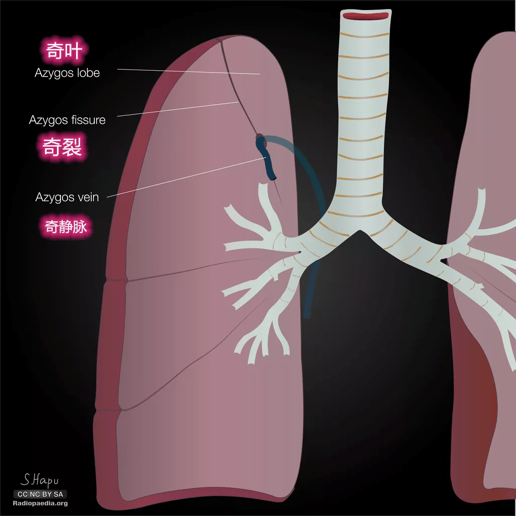 多例典型肺大泡的DR片，与大家分享！ - 医学影像学讨论版 - 爱爱医医学论坛