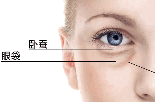 祛眼袋内切有后遗症吗?别害怕!解决其实并不难!