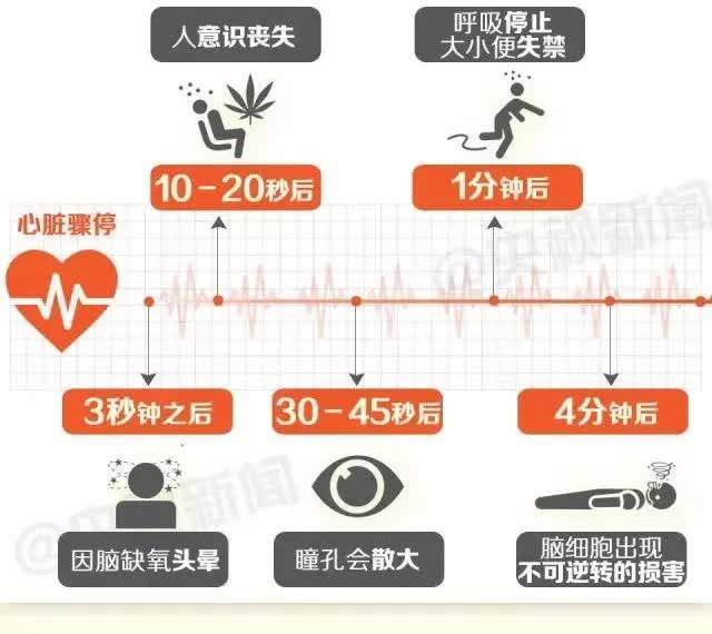 心臟驟停後產生的後果以秒計算,十秒後意識喪失,昏迷;二十秒後全身