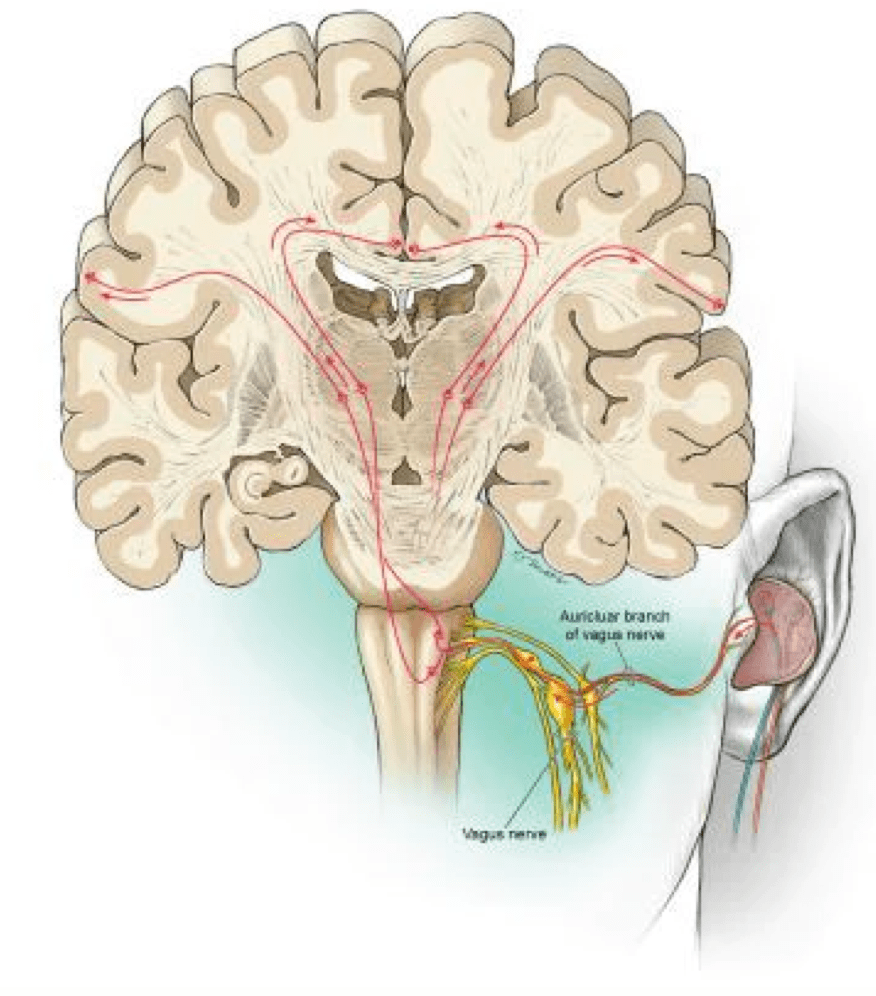 通过从外耳发出的无痛电脉冲,该设备能够刺激大脑的迷走神经.