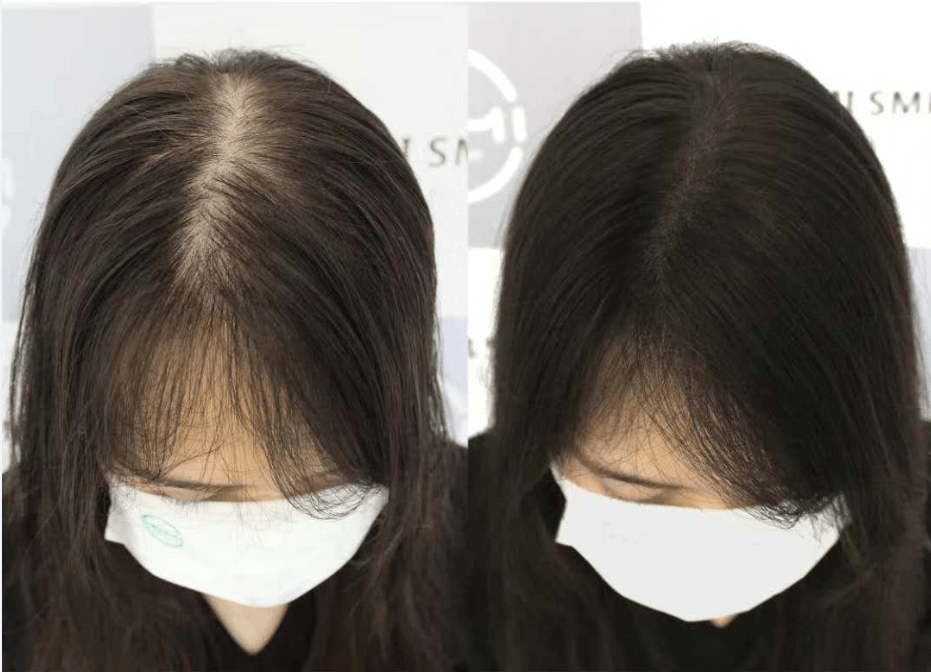 脱发这件小事我当时是这么治脱的古代皇帝拍了拍你