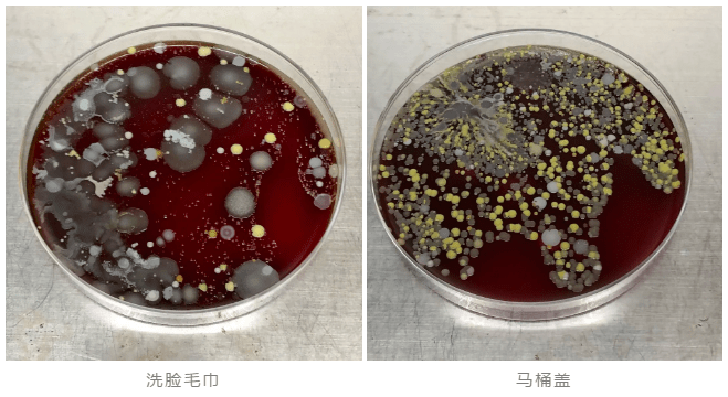 毛巾筷子牙刷細菌檢測竟比馬桶都髒每天在用卻不自知