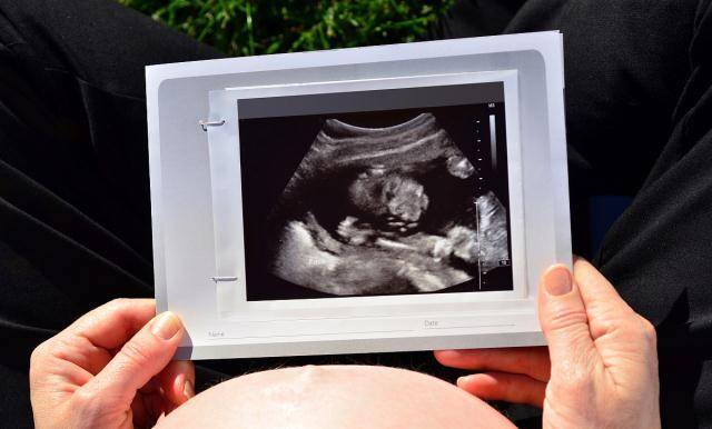 怀孕16周胎儿性别图片图片