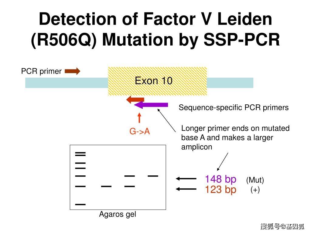 凝血因子v基因leiden突变简介