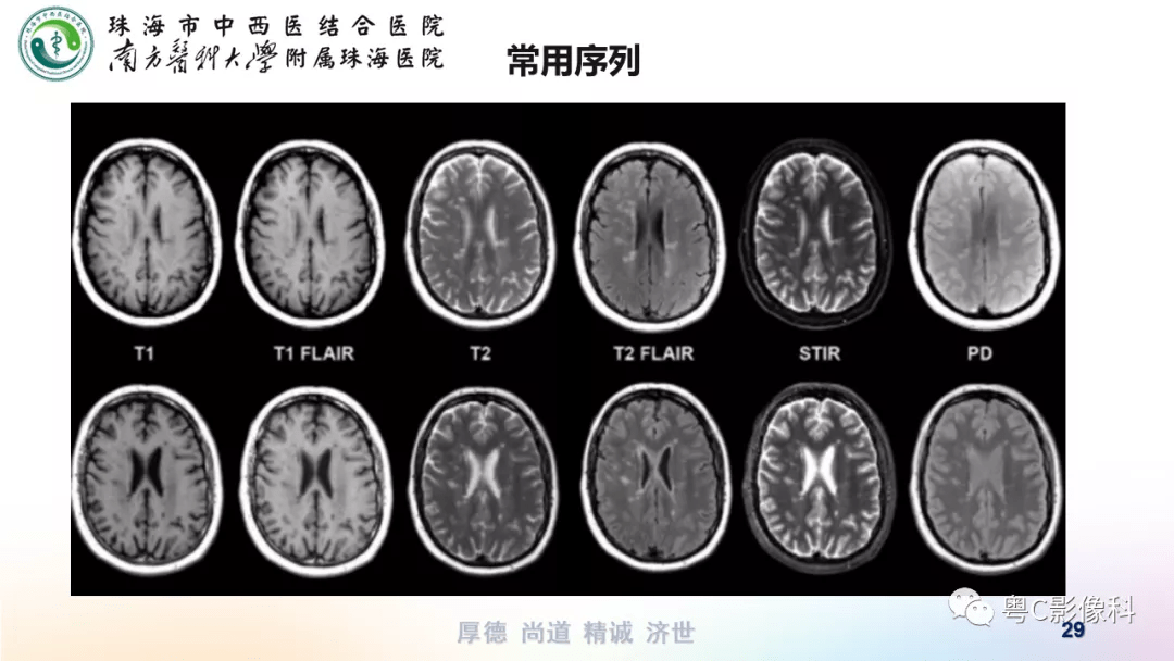 影像解剖,影像技術 :顱腦mri平掃掃描方案