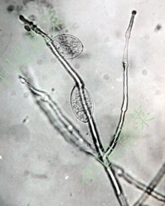 教你快速区分西红柿晚疫病与早疫病