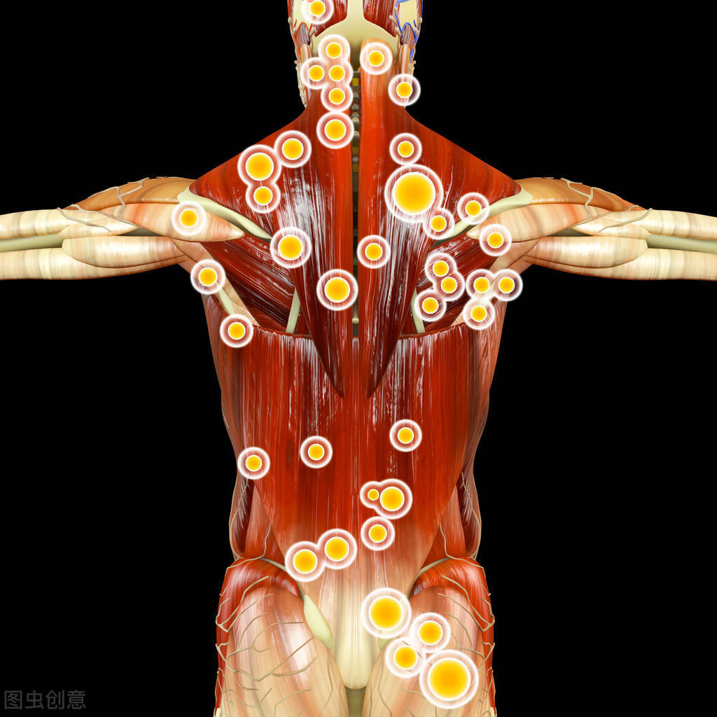 身體僵硬一拉就疼筋膜是限制靈活性重要因素