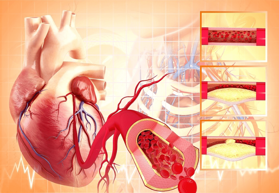 耳垂上有这条"皱纹"的,别等冠心病找上门了再"拍大腿"!_心脏
