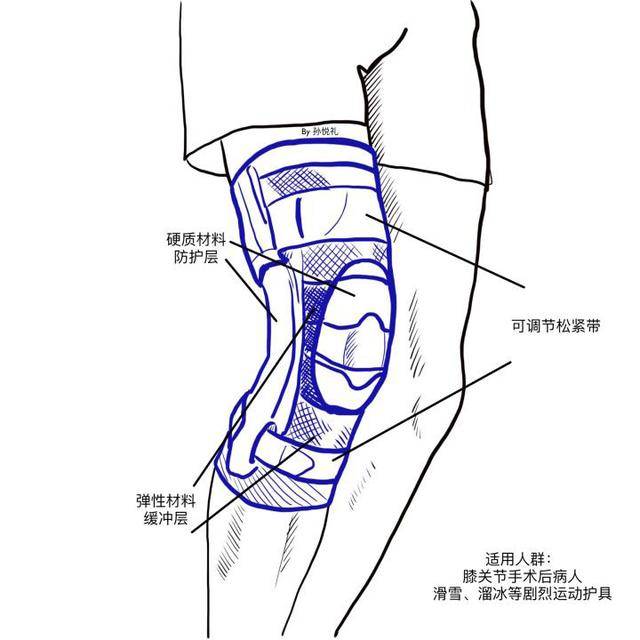 如何科学的选择运动护膝?