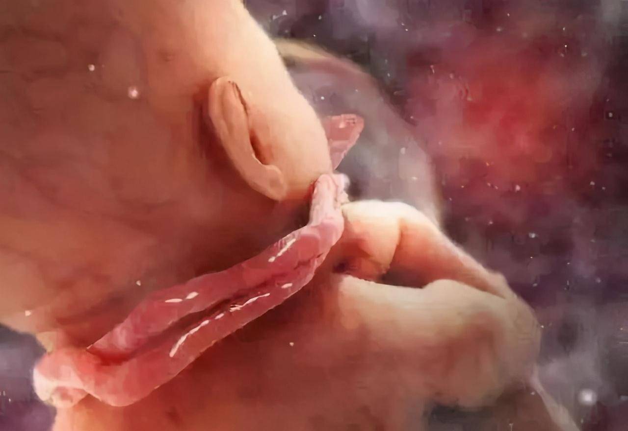 胎儿脐带绕颈图片