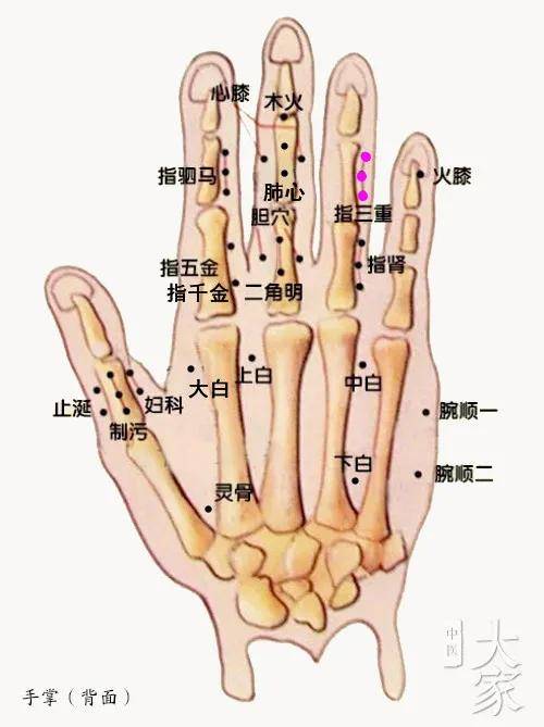 董氏穴位分享一一手指部位指三重穴中医分享仅供参考