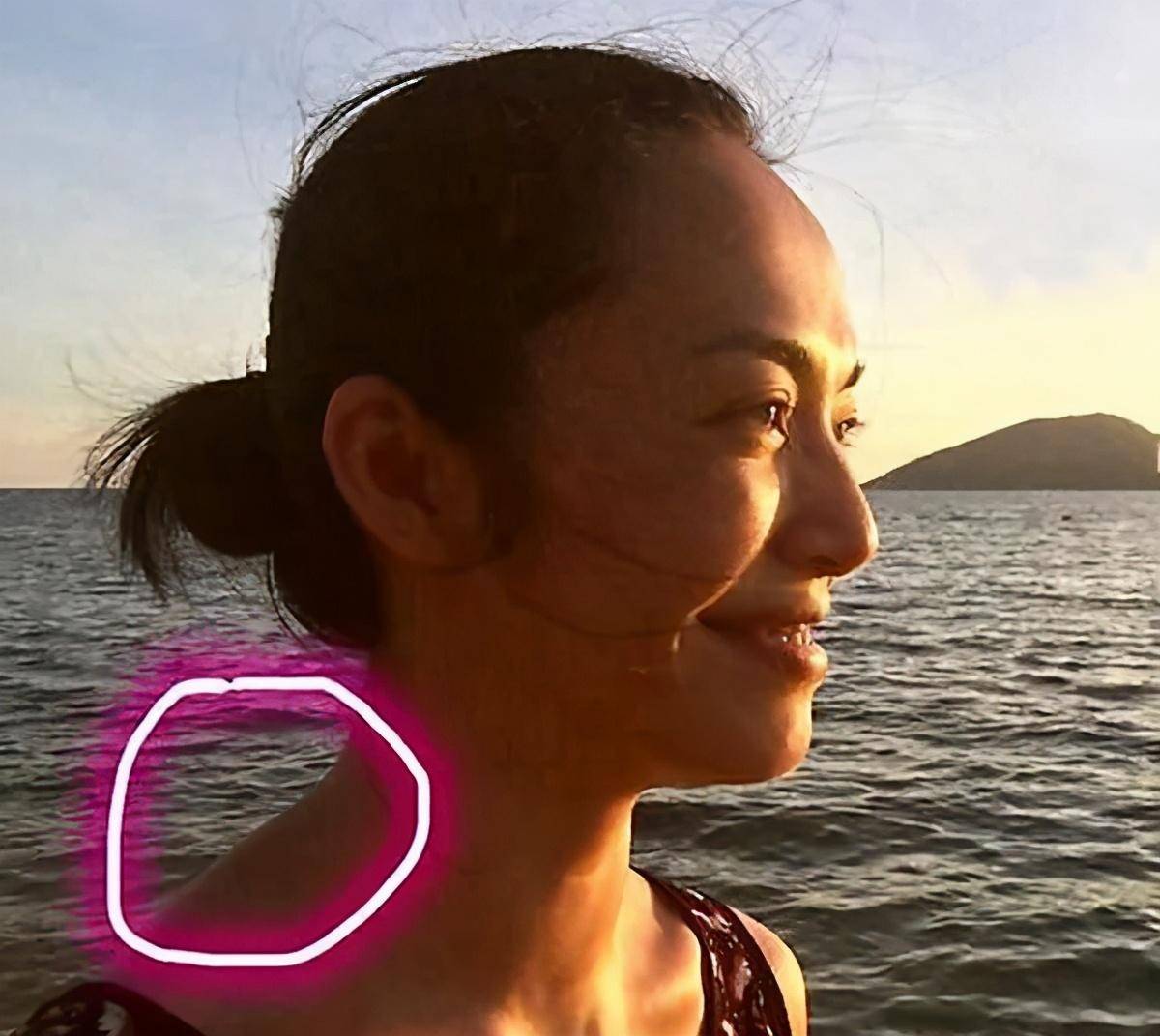 困扰女明星的富贵包竟是夺命包?