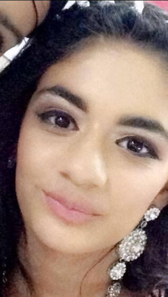 励志!英国美女意外烧伤毁容,面目全非,如今成功当上美妆博主