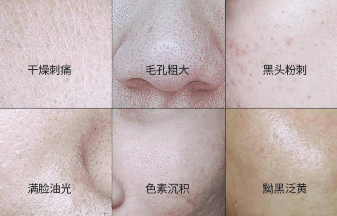 韩式皮肤管理洁面手法,看看你会不会洗脸?_污垢