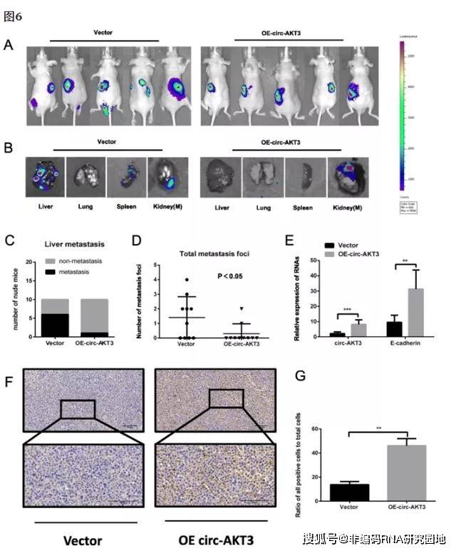 文献解读 circ-akt 3通过改变mir-296-3p/e-cadherin信号抑制肾透明
