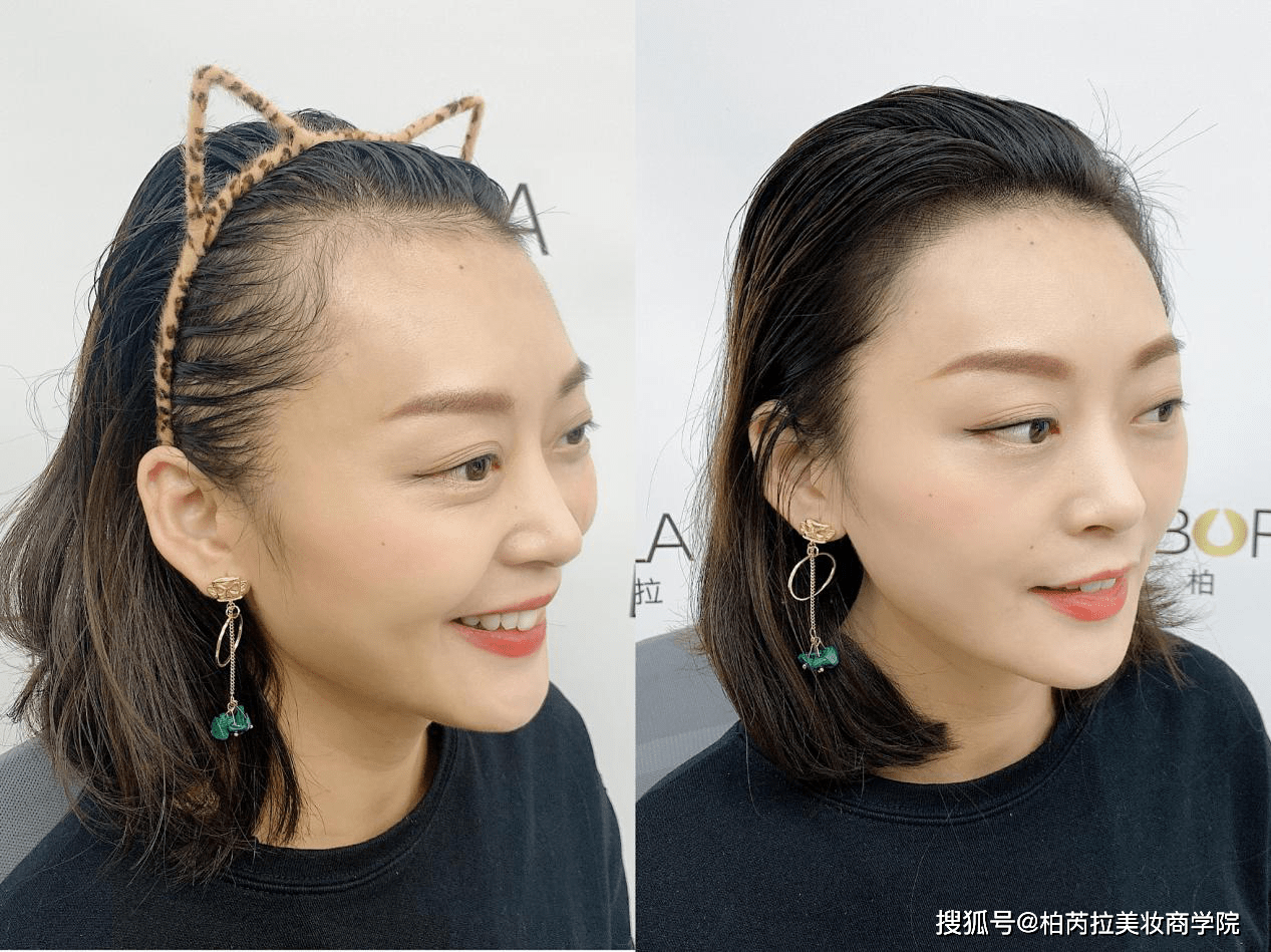 什么|科普再生发际线，如何实现激活毛囊再生的，再生发是否靠谱