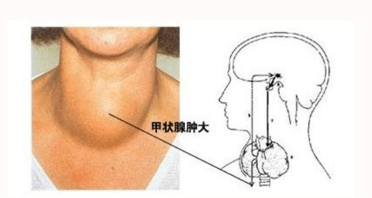 刺激甲状腺增加甲状腺素的分泌;反之,当血中甲状腺激素过高时,也会把