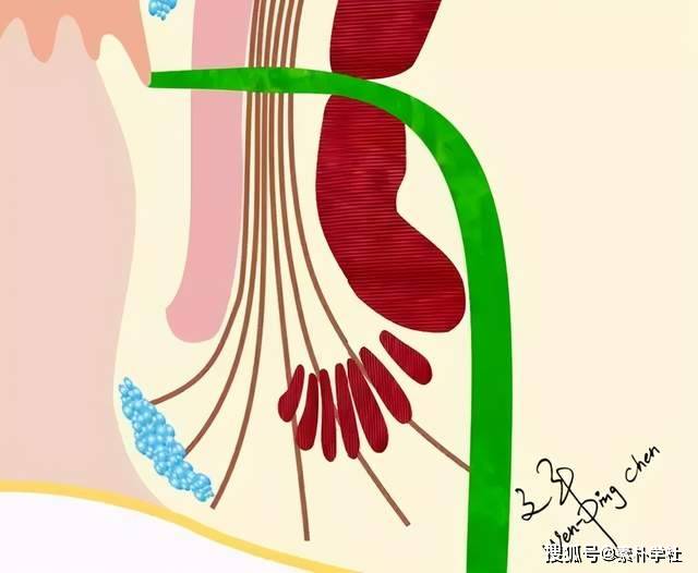 由膿腫引起的肛瘻應注意哪些問題?