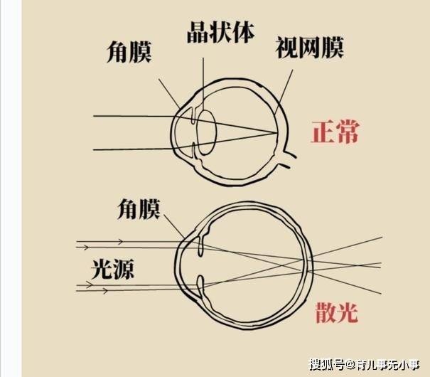 近視,弱視,斜視和遠視等,孩子的眼睛發育問題,離不開這幾類