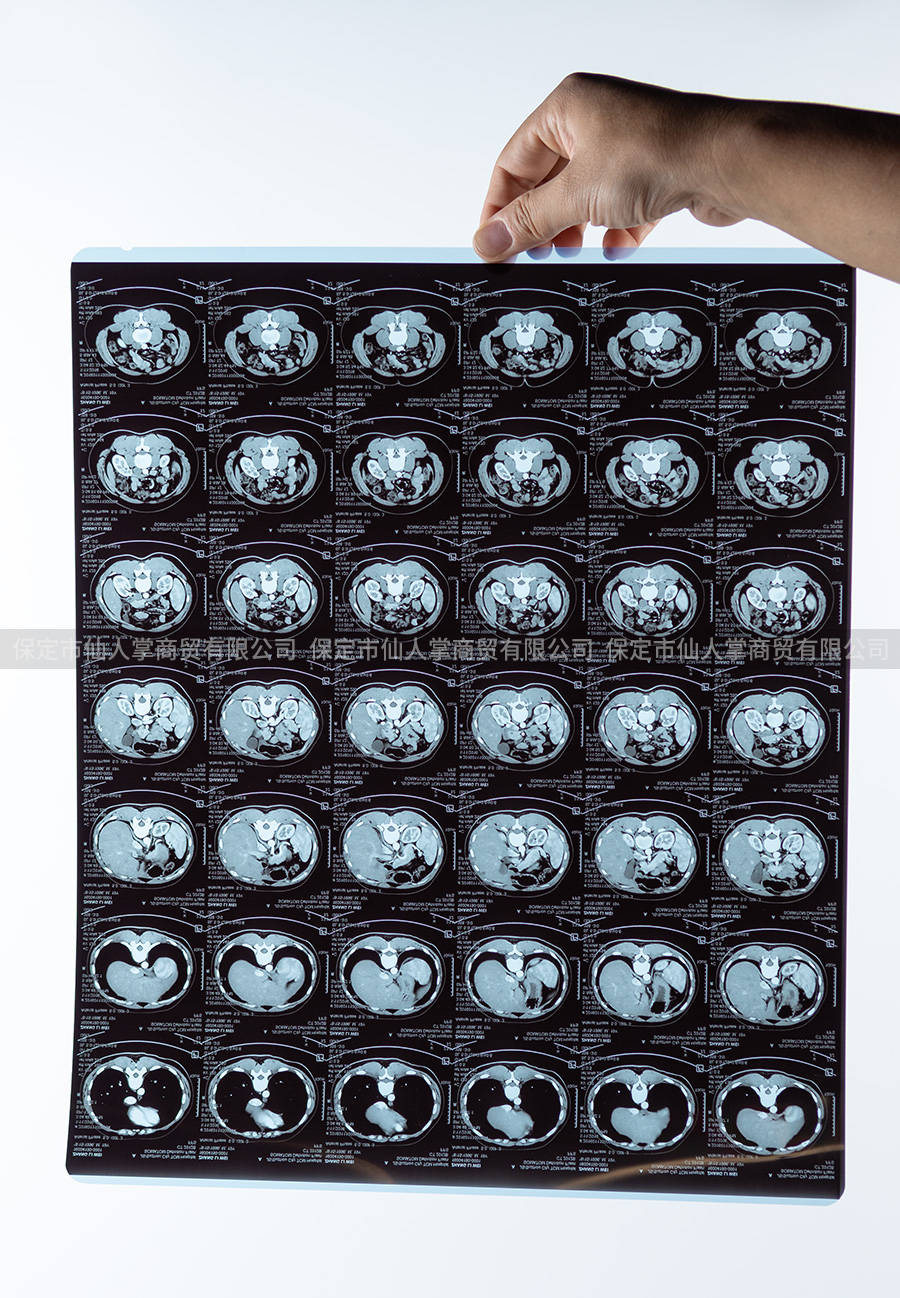 医用胶片常温胶片810101211141215