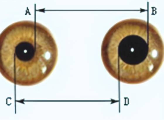 婴儿瞳孔大小标准图图片